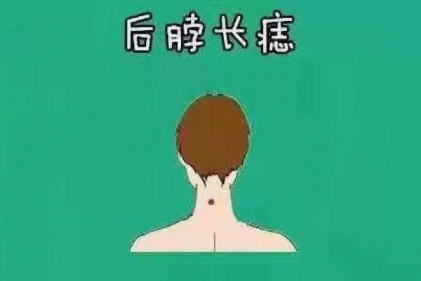 领导痣相分析：这些痣可能影响你的职业生涯