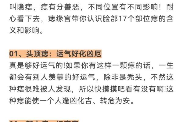 痣的位置与富贵运势的神秘关系