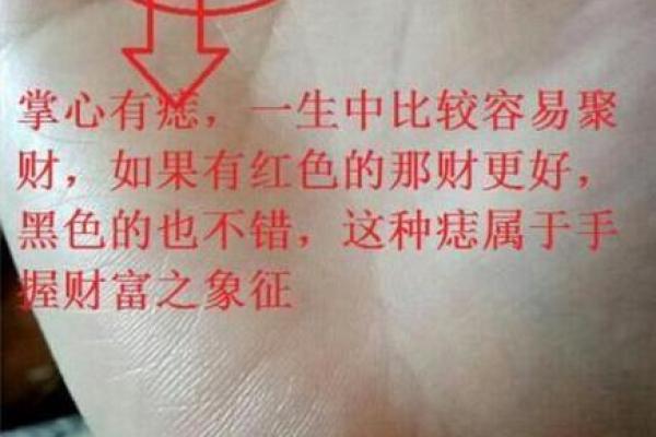 手心肉痣的象征意义与命理解析