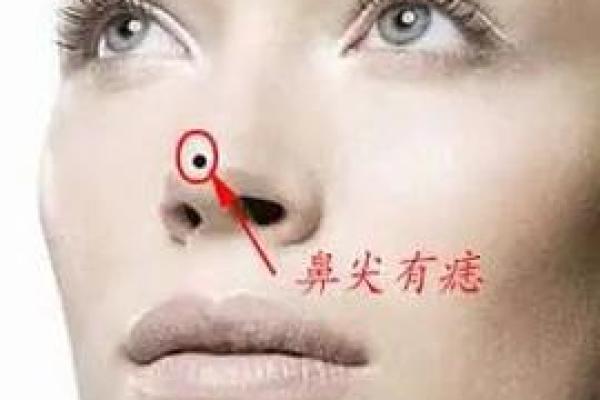 痣中藏情，揭秘烂桃花的神秘面纱