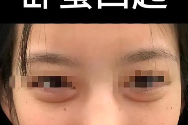 面相揭秘：眼卧蚕丝透露的运势秘密
