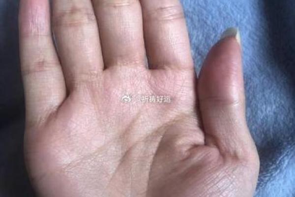 手相纹锁链：揭秘命运交织的神秘力量