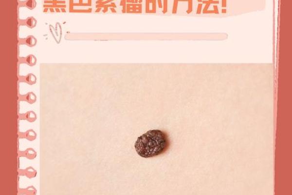痣痣相学揭秘：如何通过痣痣相找到你的财富密码？