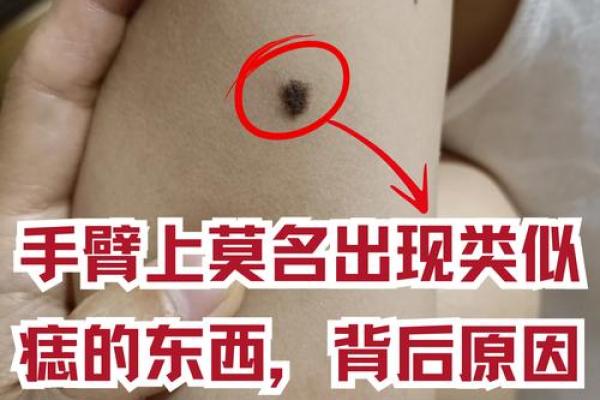 心口窝长痣的奥秘：是福是祸，一探究竟！