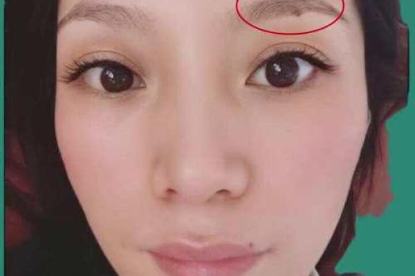 左眉藏珠，双鱼座的痣相揭秘，你读懂了吗？