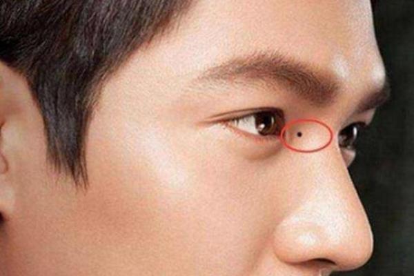 天生贵气，眉头上方痣男子魅力无限
