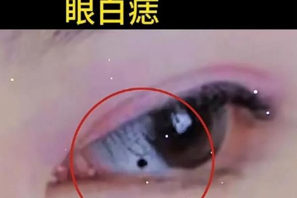 痣相揭秘：白痣的神秘魅力