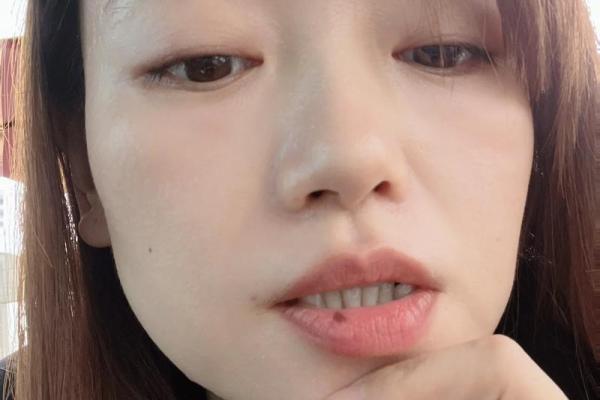 女人上唇有痣,命运如何?一探究竟! 女人上唇有痣,命运如何?一探究竟!