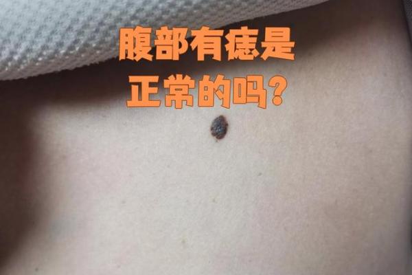 命理解码：女人肚痣预示着什么好运？