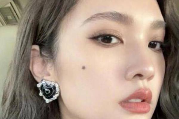 痣相解码:颈部美人痣,运势与魅力的双重保障! 痣相解码:颈部美人痣,运势与魅力的双重保障!